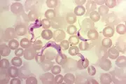 Silent Threat in California: Experts Warn of Stealthy Tropical Disease Spreading Undetected
