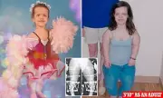 Teenager's 13-Inch Leg-Lengthening Surgery: A Journey of Pain, Courage and Transformation