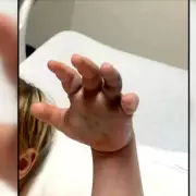 Terrifying Ordeal: Four-Year-Old Boy Bitten by Venomous Snake at UK Nursery