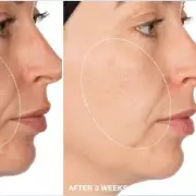 This £2.49 Anti-Ageing Gel Cream Is Selling Out Fast - Here's Why It's A Beauty Must-Have