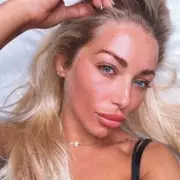 Thomas Skinner's Ex-Fling Delivers Devastating Verdict: 'A Narcissist Who Used Me For Fame' | Exclusive