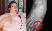 Toni Ryan's Harrowing Staircase Plunge: Inside the Shocking Fall That Left the Star Hospitalised