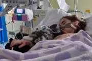 Transverse Myelitis: The Rare Spinal Cord Condition Everyone Should Know About