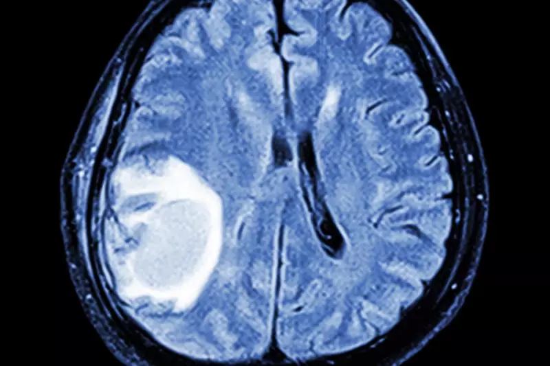 Beyond the Headache: The Hidden Signs of Brain Tumours You Should Never Ignore