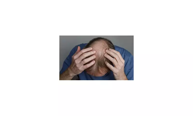 Breakthrough in Hair Loss Treatment: New Therapy Shows Remarkable Regrowth Potential