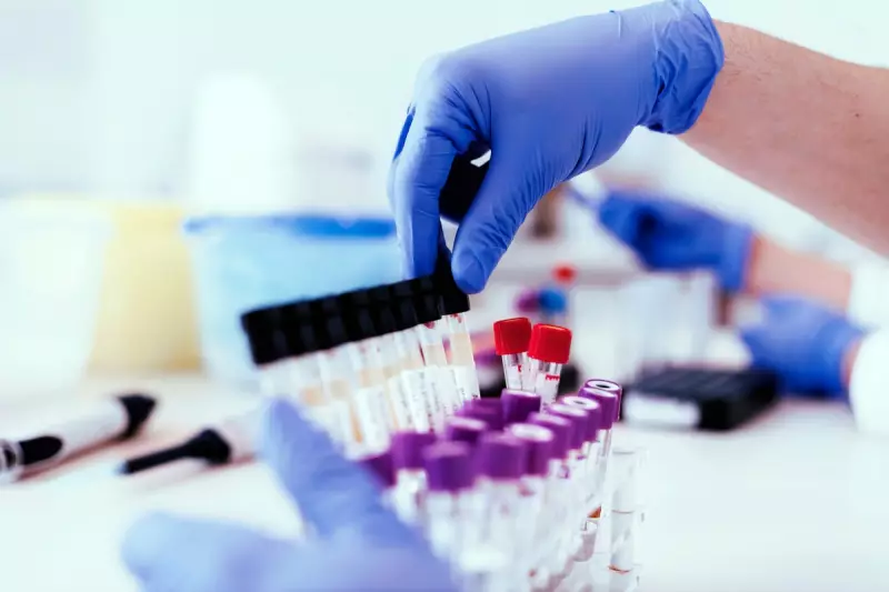 Breakthrough Urine Test Could Detect Early Signs of Vascular Dementia, UK Scientists Reveal