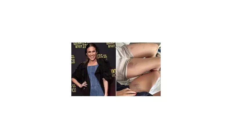 Former Bachelorette Georgia Love Reveals Mysterious Leg Bruises Sparking Health Concerns