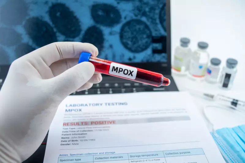 Monkeypox Alert: Los Angeles Confirms First Case Amid Growing US Outbreak