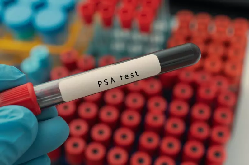 NHS Prostate Cancer Testing Crisis: Why Men Are Being Denied Life-Saving Checks
