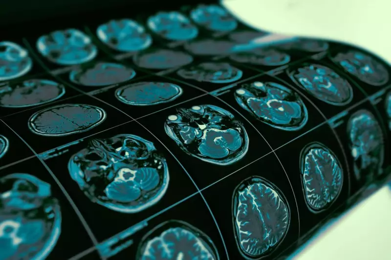 NHS Rejects Groundbreaking Brain Cancer Drug Vorasidenib in Major Blow to Patients