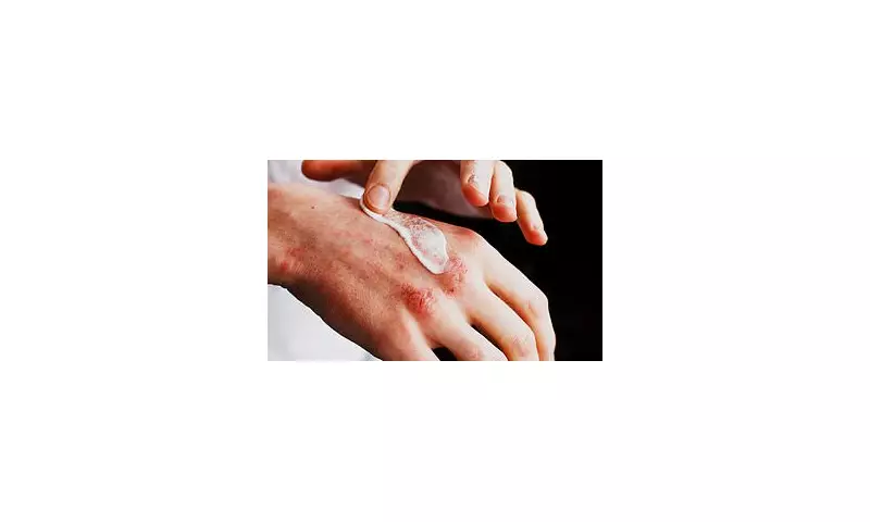 Revolutionary Skin Creams With Cancer-Fighting Properties Now Available on NHS Prescription