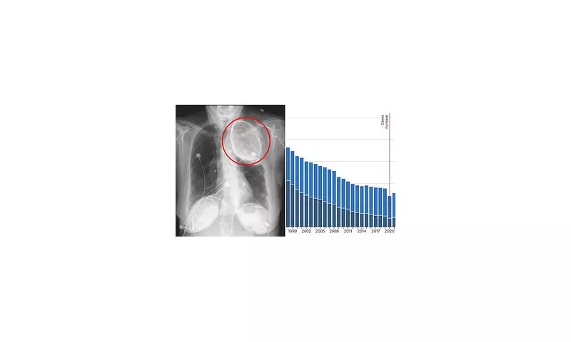 Shocking Medical Scan Reveals The Hidden Damage Of Tuberculosis Treatment