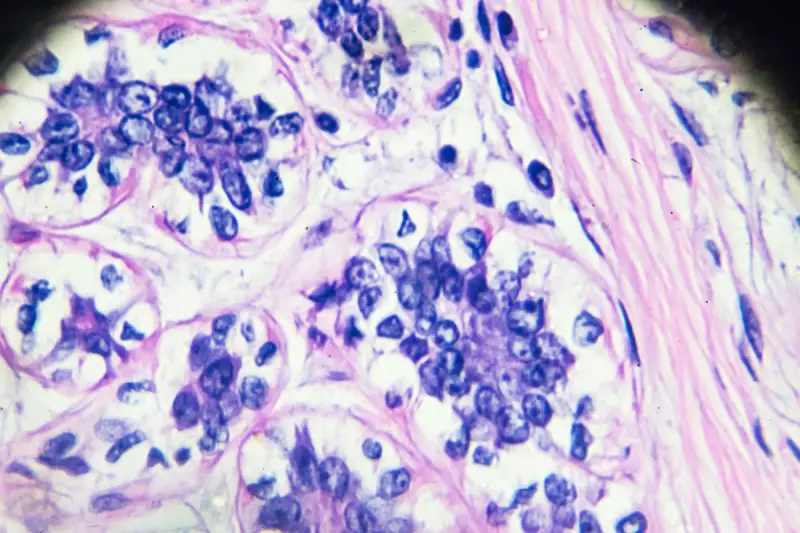 Shocking Study Reveals Obesity Now Linked to 32 Types of Cancer