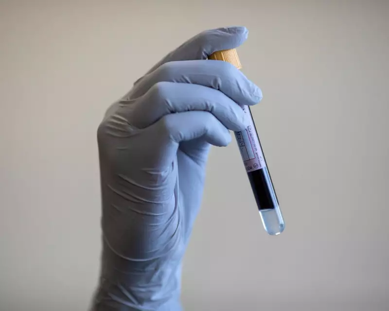 Targeted Prostate Screening Could Save Thousands of Lives in UK, Experts Say