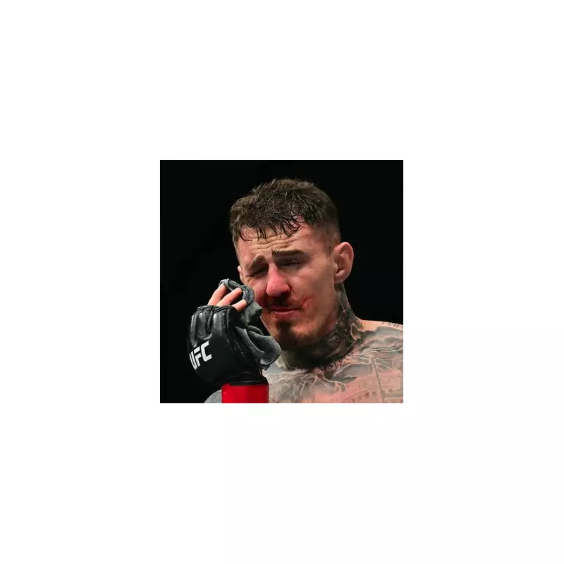 Tom Aspinall Hospitalised After Terrifying UFC 304 Training Injury - Full Details