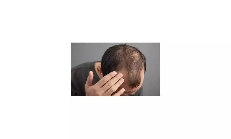 Your Hair Knows Your Secrets: Scientists Reveal How Strands Betray Your Lifestyle and Location