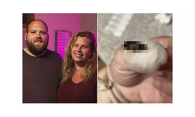 Doctors Mistook Wriggling Sensation for Drug Use - The Shocking Truth Was Crawling in Her Ears