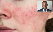 Autumn Skin SOS: Dermatologist Reveals How to Combat Cold Weather Flare-Ups