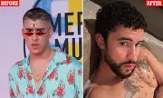 Bad Bunny's Dramatic Transformation: Has The Latin Superstar Gone Under The Knife?