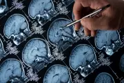 Breakthrough Discovery: Your Sense of Smell Could Predict Alzheimer's and Parkinson's Years Before Symptoms Appear