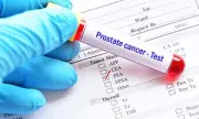 Breakthrough Prostate Cancer Screening Cuts Death Risk by 35%, Major Study Reveals