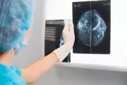 Breast Cancer Breakthrough: Common Drug Tamoxifen Extends Lives for Decades, Major Study Reveals