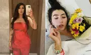 British Woman Wakes from Stroke Speaking with Foreign Accent Syndrome