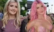 Denise Richards' Daughter Sami Sheen Opens Up About Cosmetic Surgery Journey in Candid Social Media Revelation