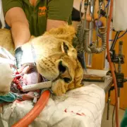 Dentist Discovers 8cm Tooth Growing in Man's Nose in Shocking Medical Anomaly