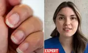 Doctor Reveals: The 7 Unexpected Warning Signs of Deadly Liver Disease You're Probably Ignoring