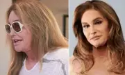 Fans Voice Concern Over Caitlyn Jenner's 'Concerning' Appearance on The Kardashians