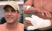 Florida Coast Terror: Shark Mauls Snorkeller in Brutal Miami Attack
