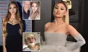 Grace Hyland's Transformation: The Ariana Grande Lookalike Who Says 'No' to Plastic Surgery