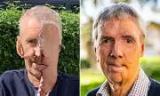 Grandfather's Remarkable Recovery: 3D-Printed Face Gives New Hope After Drunk Driving Horror