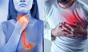 Heart Attack Alert: The Hidden Danger of Acid Reflux You Need to Know About