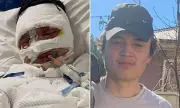 Heroic Teen's Fiery Ordeal: Jacob Thompson's Miraculous Survival After Petrol Station Inferno