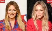 Hilary Duff Opens Up About Cosmetic Procedures: 'I Stopped The Fillers' | Exclusive Interview