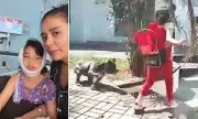 Hollywood Horror: Pit Bull Mauls Young Girl in Florida Neighbourhood Attack