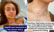 Love Island Star Demi Jones' Brave Cancer Battle: Her Emotional Journey After Thyroid Diagnosis at 22