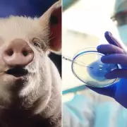 Medical Marvel: Fish Skin Grafts and Pig Heart Transplants Revolutionise NHS Treatment