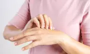 NHS Breakthrough: First Ever Hand Eczema Treatment Cream Approved for Millions of Sufferers