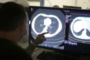 NHS Prescription Game-Changer: Stop-Smoking Drug Now Available Across UK