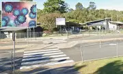 Queensland Faces Urgent Measles Crisis as Multiple Cases Emerge Across the State