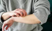 Science-Backed Solutions: How to Stop Itchy Skin Without Damaging Your Skin