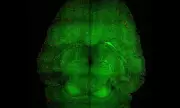 Scientific Breakthrough: Alzheimer's Symptoms REVERSED in Groundbreaking Mouse Study