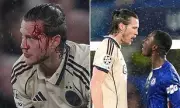 Shocking Injury Halts Champions League Clash as Manchester United Flop Suffers Gruesome Head Wound