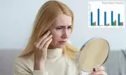Skin Deep Warning: How Your Skin Could Reveal Mental Health Crisis Years Before Psychosis