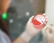 Superbug Crisis: UK Faces Tipping Point as Drug-Resistant Infections Surge