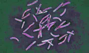 TB Alert: UK Health Chiefs Sound Alarm as World's Deadliest Infection Makes Worrying Comeback