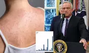 Texas Measles Outbreak: Urgent Health Alert as Cases Emerge - Know the Signs